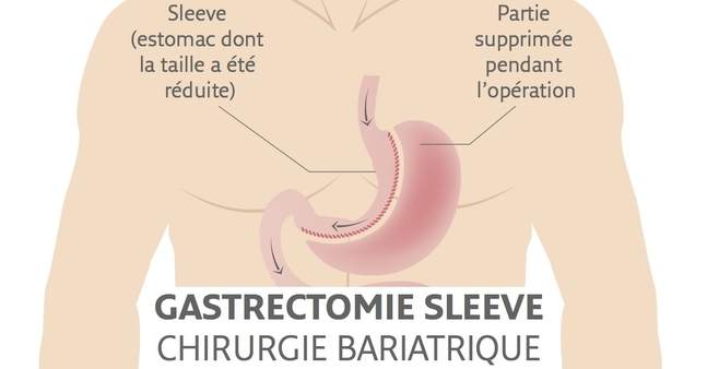 guerir du diabetes 2 guerir du diabetes 2